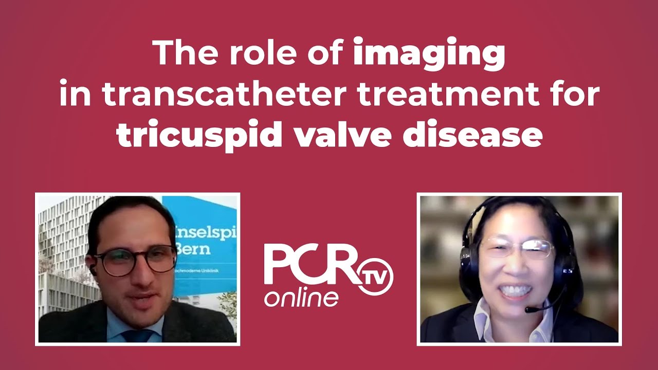 The role of imaging in transcatheter treatment for tricuspid valve ...