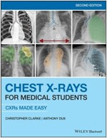 Chest X-Rays for Medical Students : CXRs Made Easy (Paperback, 2 ed)