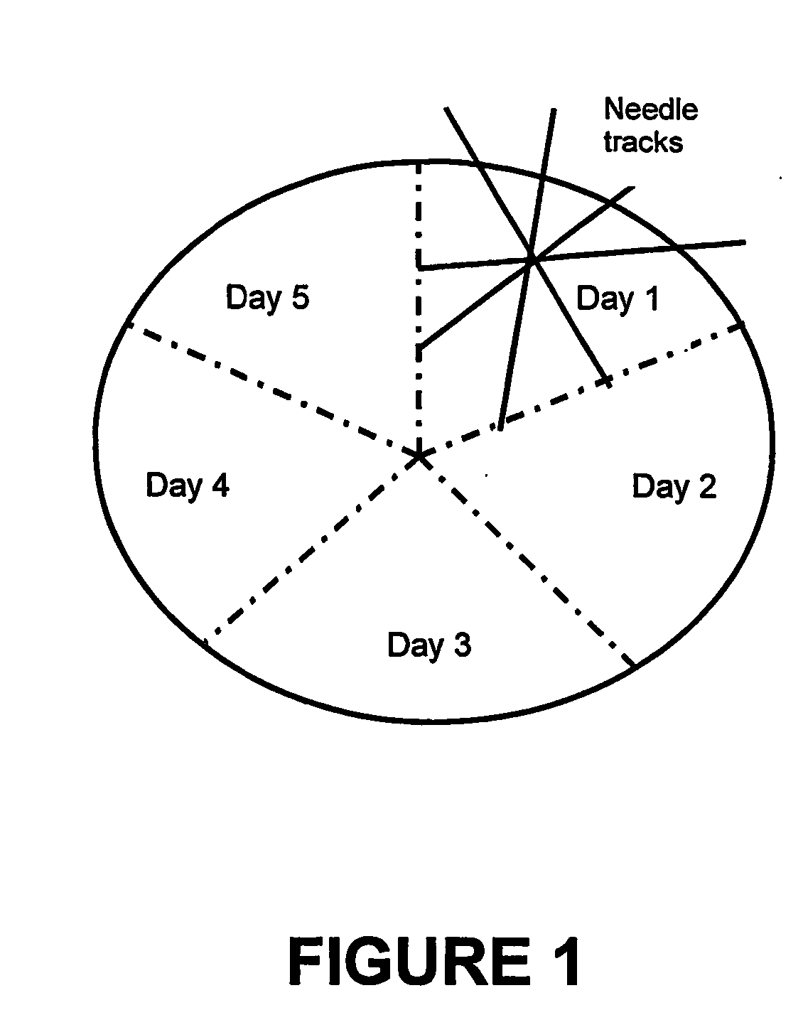 Methods for treating cancer using an immunotoxin