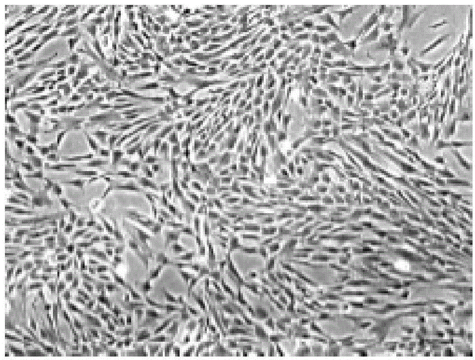 SFM (serum-free medium) for culturing MSCs (mesenchymal stem cells)