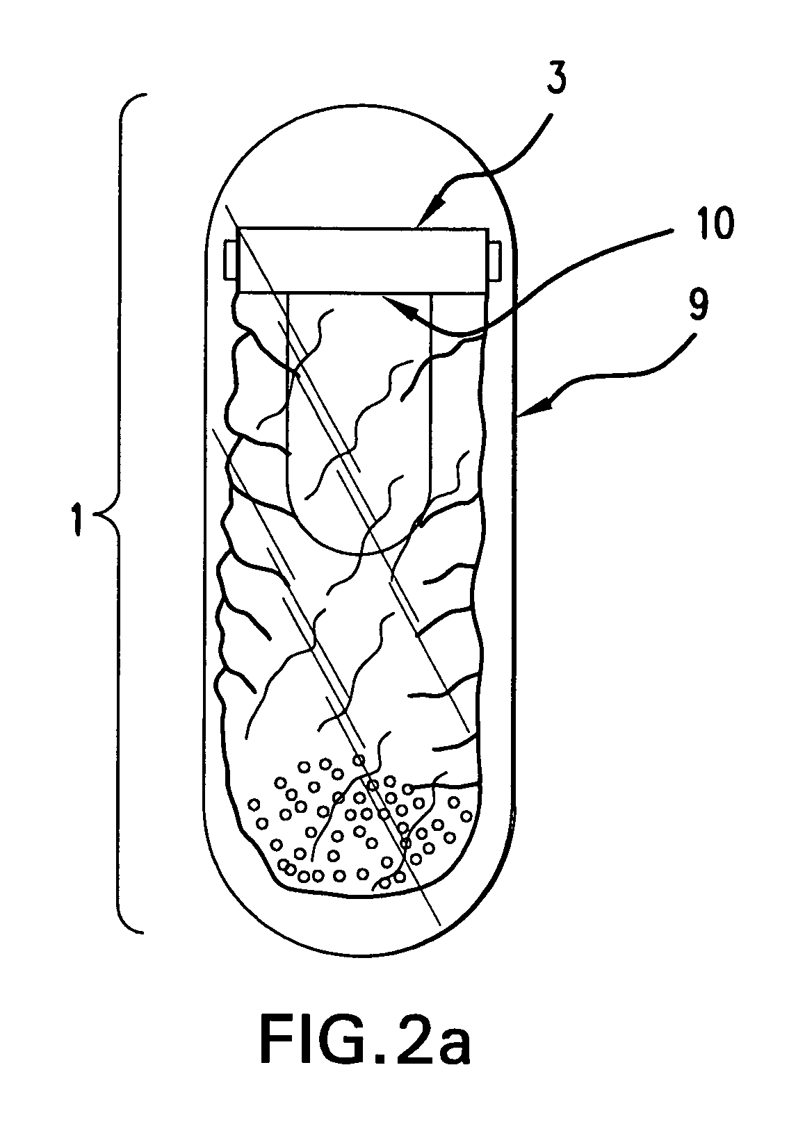 Self-inflating intragastric volume-occupying device