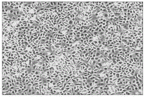 Human skin epidermal cell culture medium and application thereof