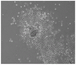 Human skin epidermal cell culture medium and application thereof