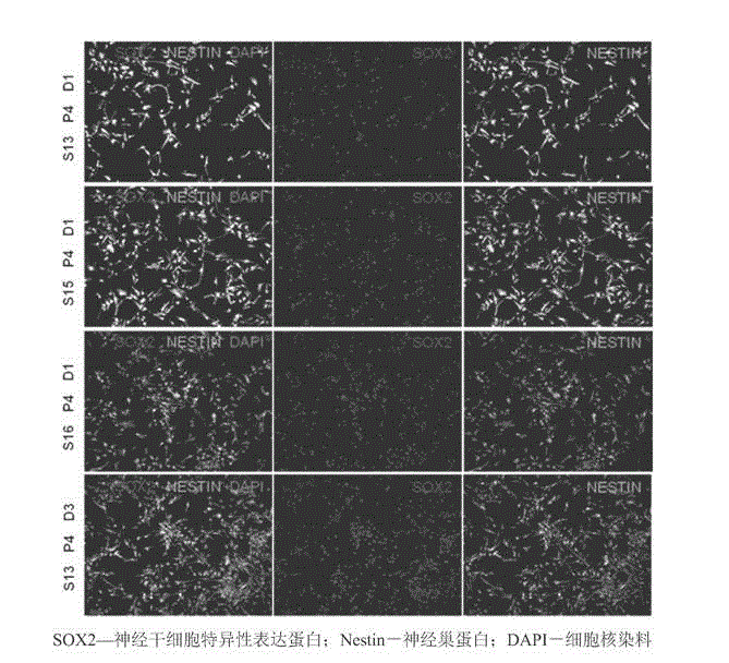 Clinical-grade serum-free medium for adherent culture of human neural stem cells