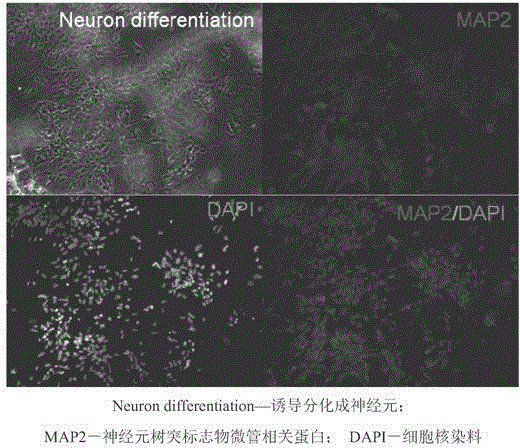 Clinical-grade serum-free medium for adherent culture of human neural stem cells