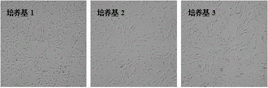 Serum-free human amniotic mesenchymal stem cell culture medium and preparation method thereof