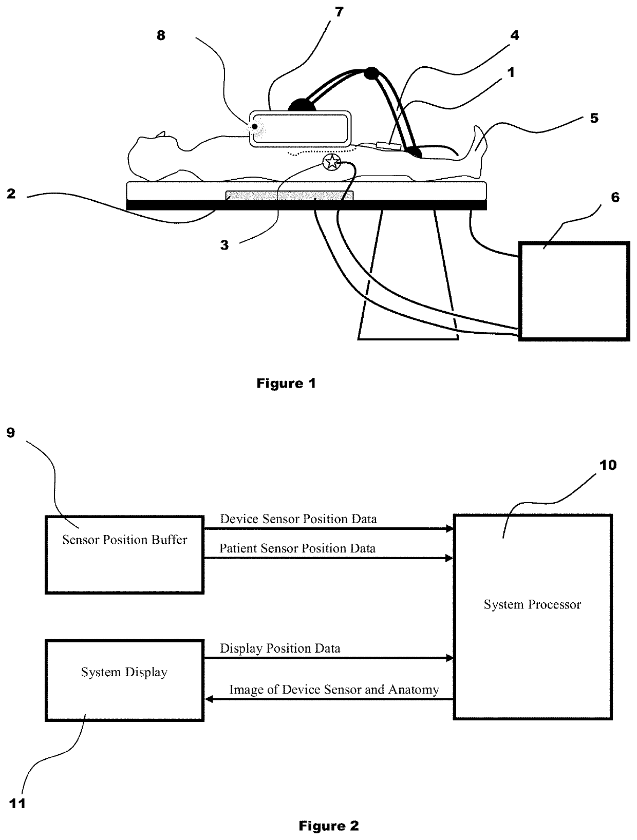 System and method for displaying anatomy and devices on a movable display