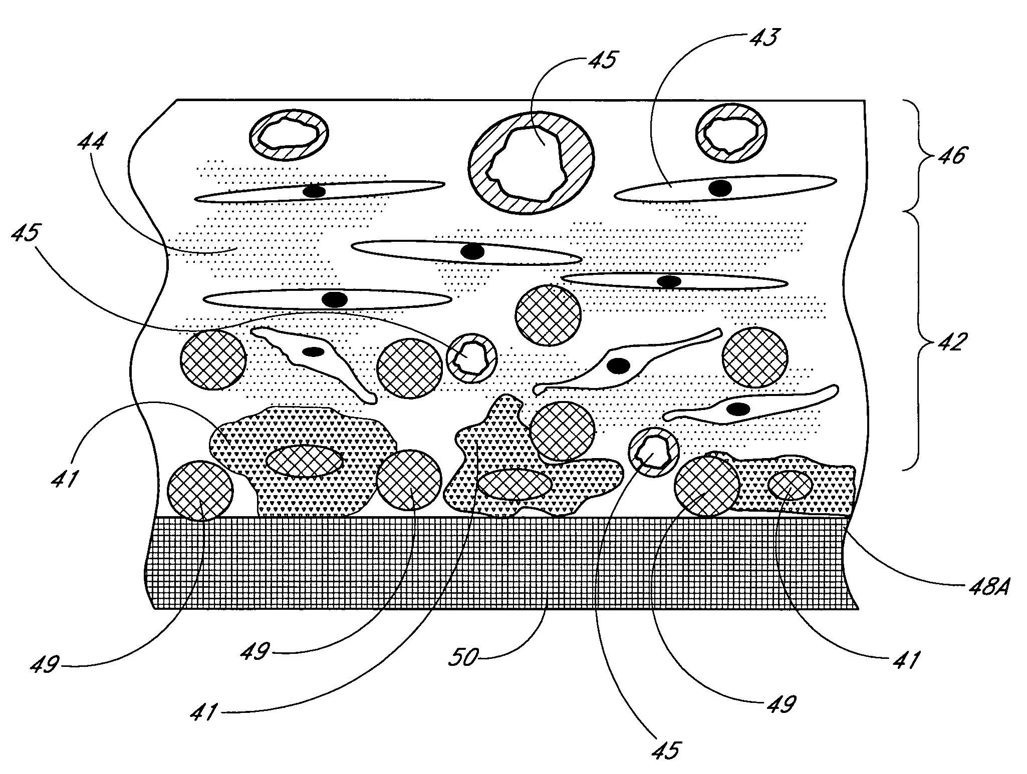 Membrane for use with implantable devices