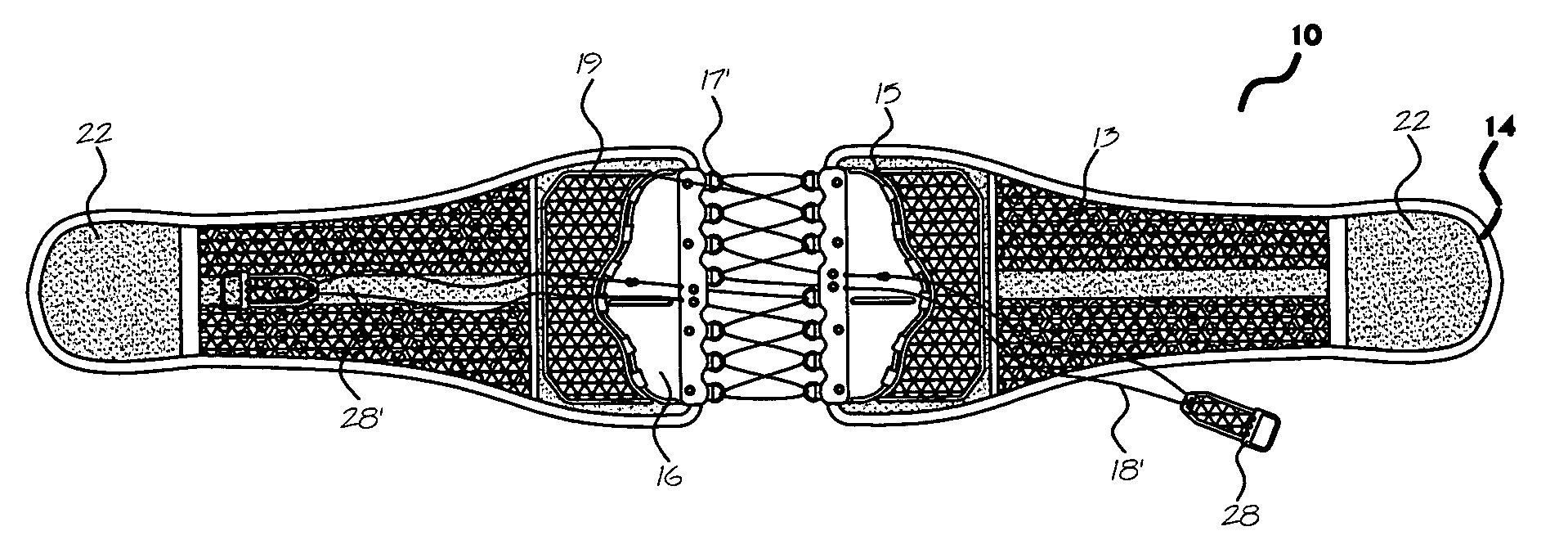 String arrangement of a separate back immobilizing, dynamically self-adjusting, customizing back support for a vertebra related patient