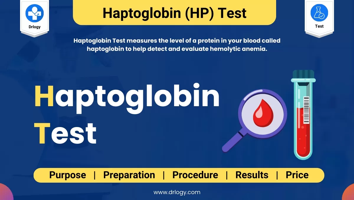 Haptoglobin Test For Hemolytic Anemia Condition Explained