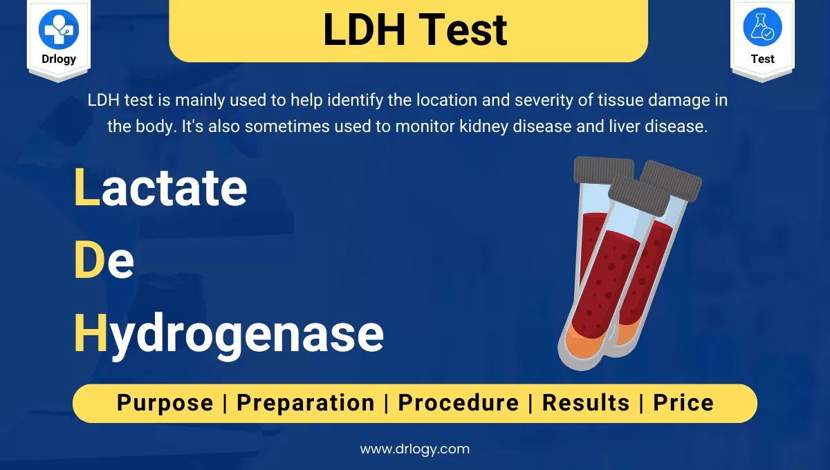 Lactate Dehydrogenase Test To Locates and Gauges Tissue Damage