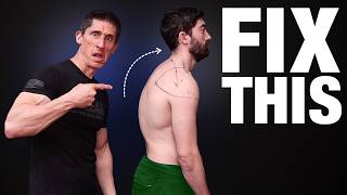 How to Fix Rounded Shoulders (FOREVER!)