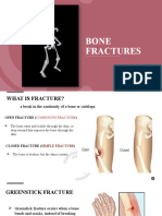 Bone Fractures