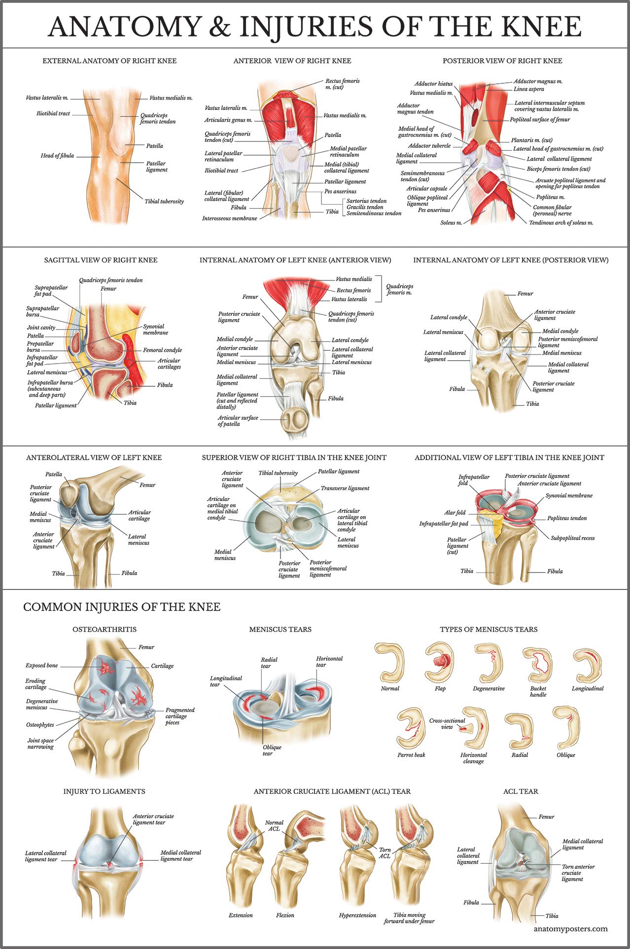 Buy Palace Learning Laminated Anatomy and Injuries of the Knee - Knee ...