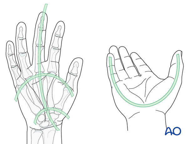 Anatomical architecture of the whole hand with its arcs