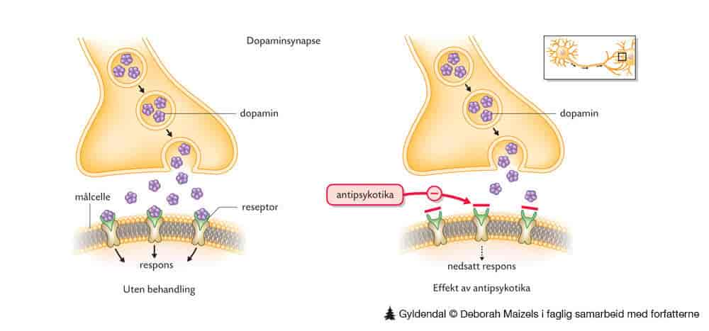 Antipsykotika