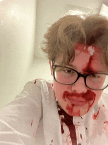 a person with blood on their face wearing glasses and a white shirt