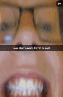 a close up of a person 's face with glasses and a caption that says look at my cavities they 're so cool