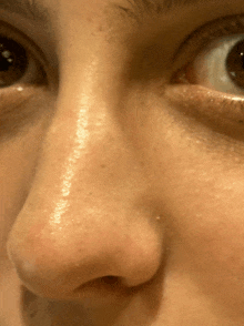 a close up of a person 's nose with a few spots on it