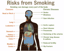 a diagram showing the risks from smoking and the chronic diseases