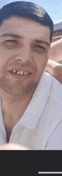 a man with missing teeth is smiling for the camera while wearing a white shirt