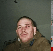 a man with a black eye and a shaved head takes a selfie