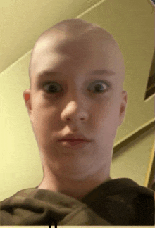 a young man with a shaved head looks at the camera