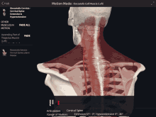 a computer screen shows the muscles in the neck