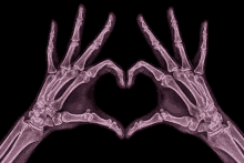 an x-ray of two hands making a heart shape with their bones .