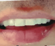 a close up of a person 's mouth with white teeth