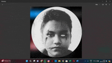 a computer screen shows a picture of a boy with stitches on his face