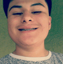 a young man with braces on his teeth is smiling for a picture .