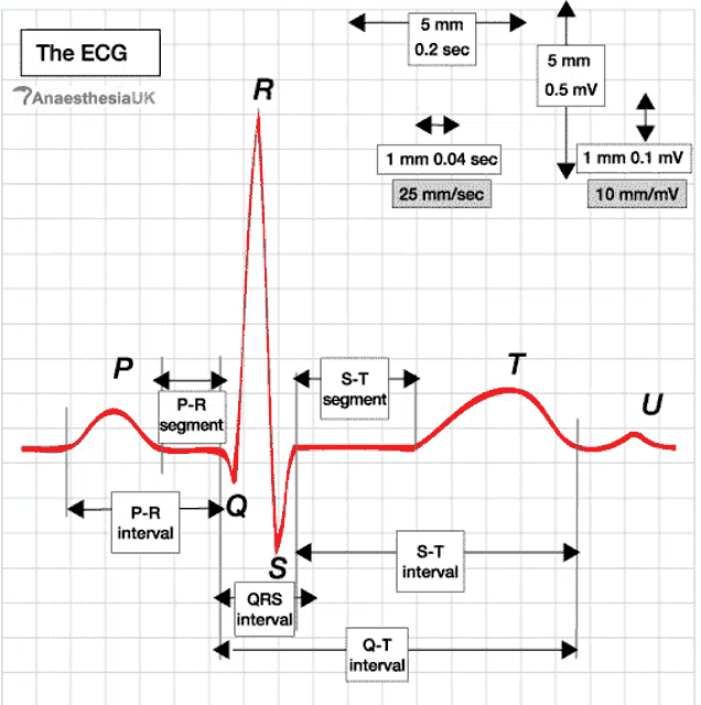 a diagram of the ecg shows the s-t segment and p-r segment