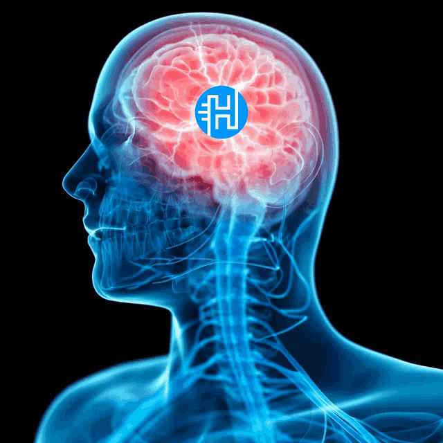 a x-ray of a person 's head with a blue h on it