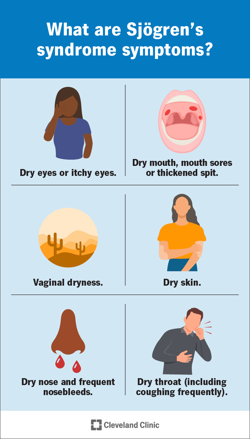 Sjögren’s syndrome causes chronic dryness throughout your body.