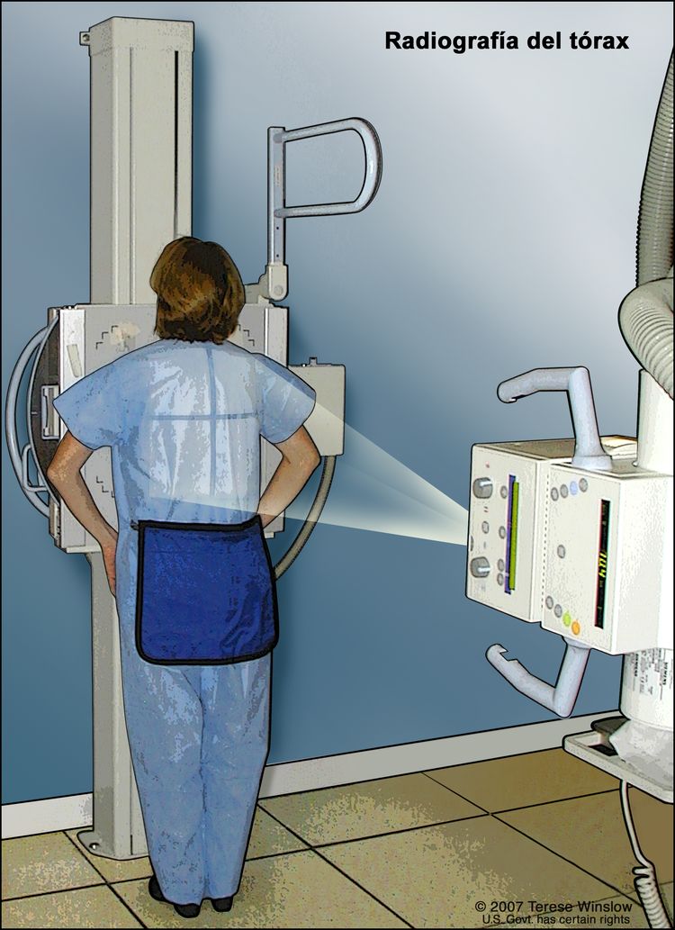 Radiografía del tórax. En el dibujo se muestra a una paciente de pie con la espalda hacia la máquina de rayos-X. Los rayos X pasan a través del cuerpo de la paciente y se plasman en una película o computadora; de esta manera, se toman imágenes de las estructuras y los órganos en el interior del tórax.