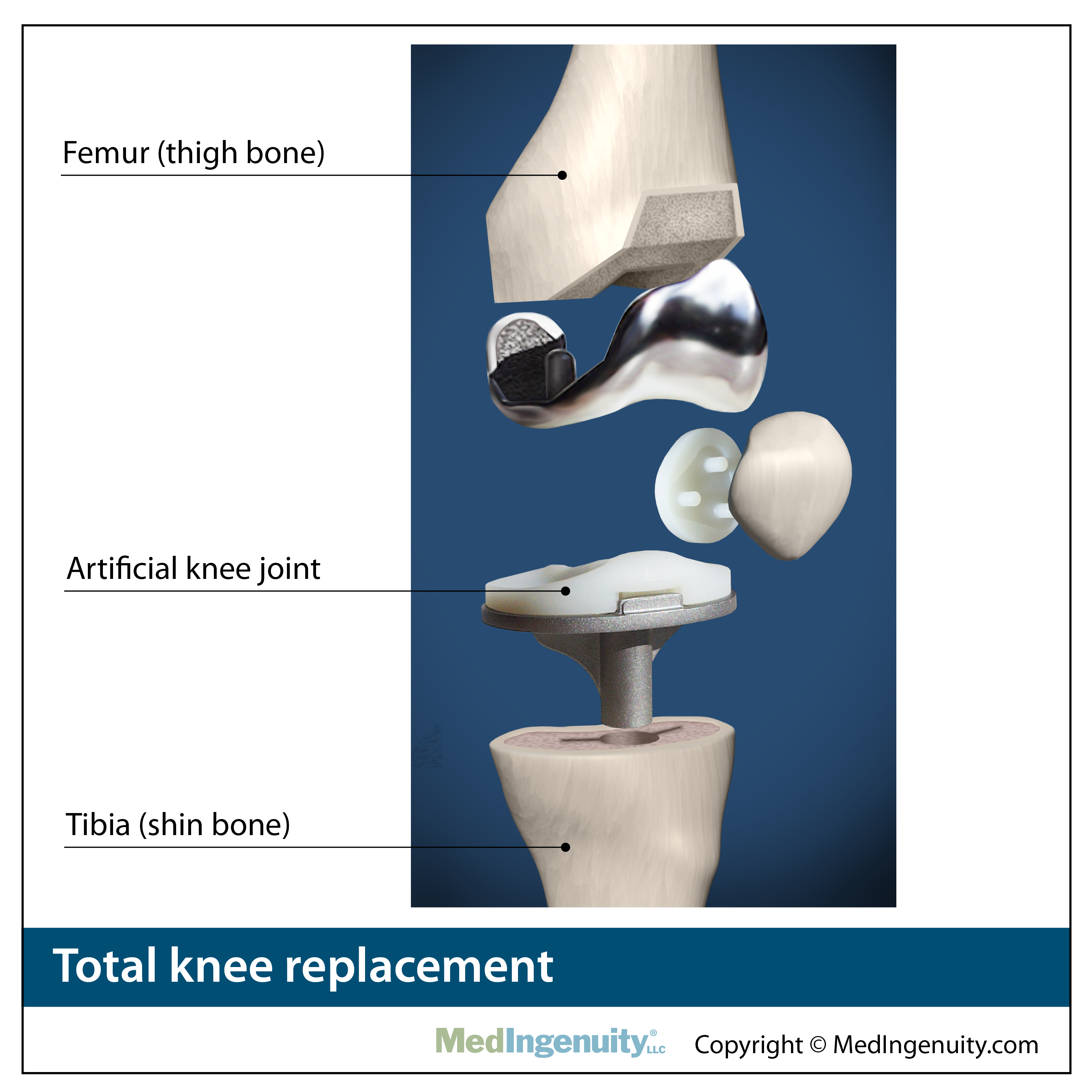 Complete anatomy of the knee - bastatn