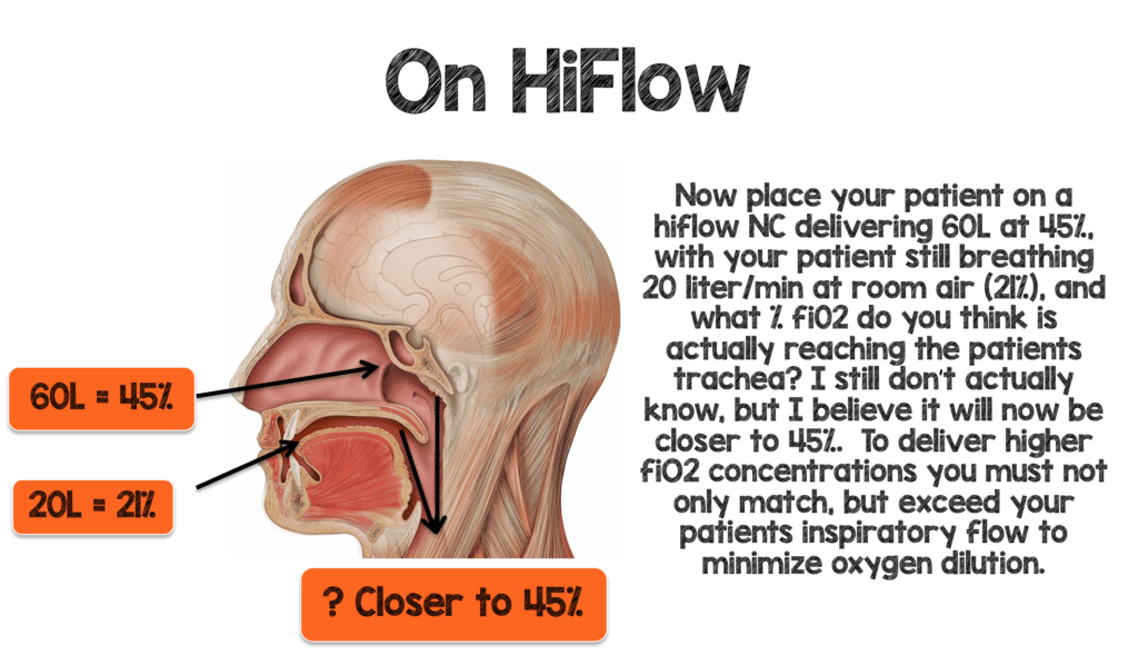 REBEL Crit Cast Episode 2.0: Overview of High Flow Nasal ...