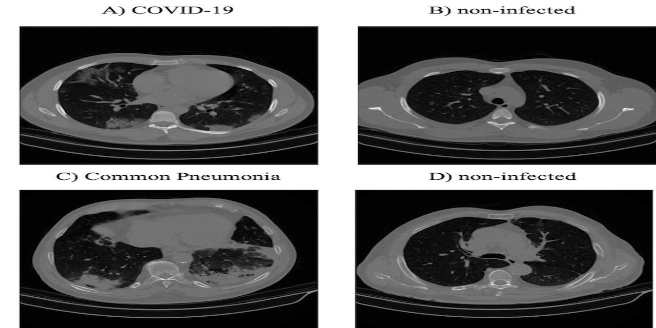 COVID-CT-MD