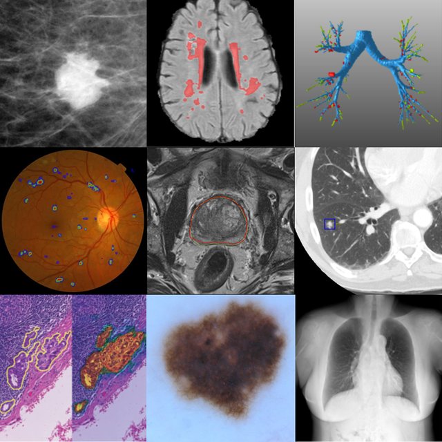 diagnosztikai_celu_orvosi_kepalkotas