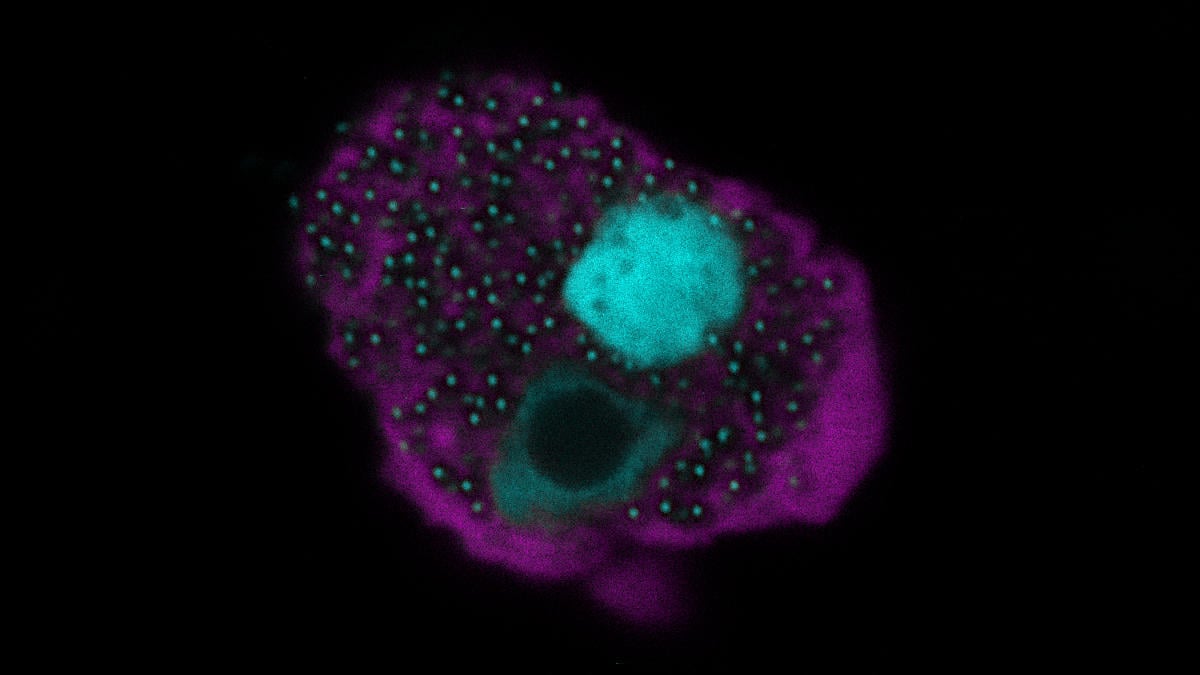 An-Amoeba-Cell-Infected-by-Naegleriavirus.jpg