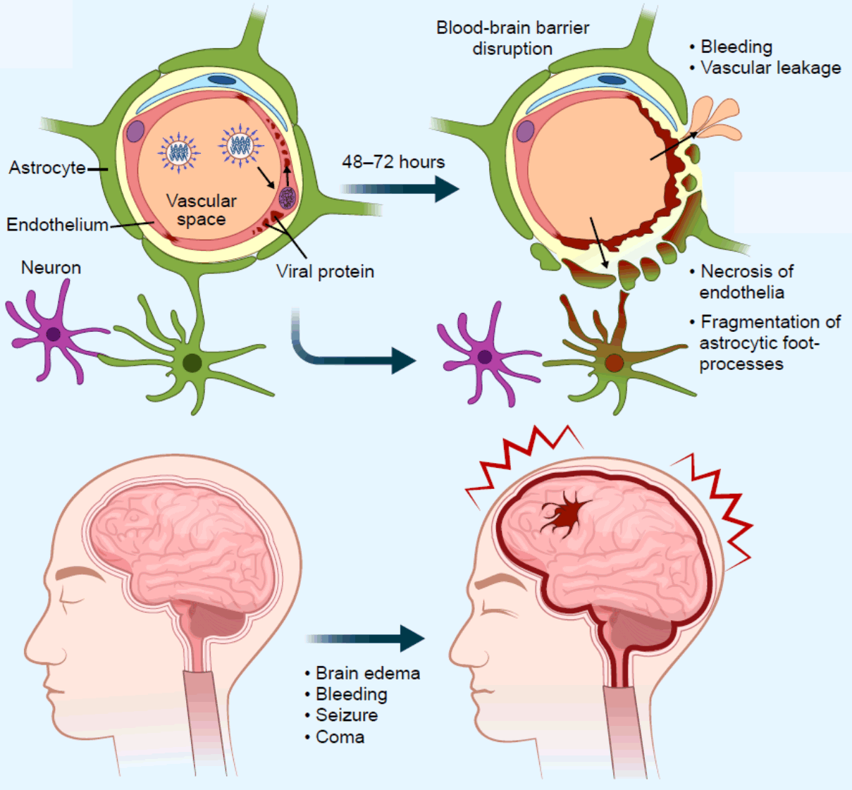 IAE-Pathogenesis-With-Severe-Brain-Edema-Caused-by-IAV.png