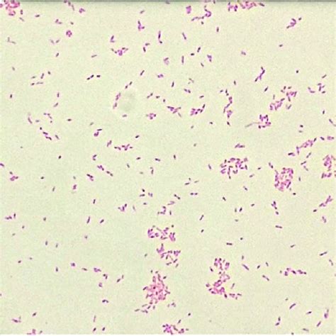 Campylobacter Jejuni Gram Stain The Small Gram Negative Rods Are C06