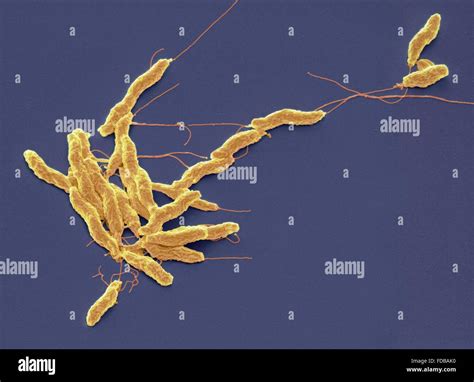 Campylobacter Jejuni Bacteria Coloured Scanning Electron Micrograph