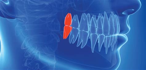 Everything You Need To Know About Wisdom Teeth