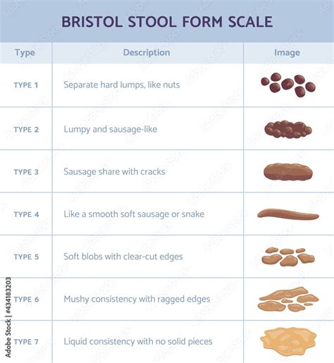 Bristol Scale Chart Stool Bristol Scale Constipation Chart Stanford