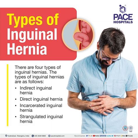 Inguinal Hernia Signs And Symptoms Types Causes Risk Factors