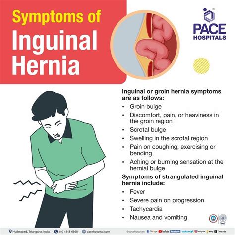 Inguinal Hernia Signs And Symptoms Types Causes Risk Factors