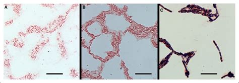 Bacterial Microscopy And Gram Stain Showing Gram Negative Rods Gram