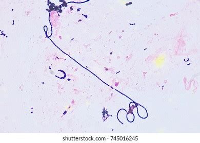 Gram Positive Cocci Chains Bilder Stockfotos Und Vektorgrafiken